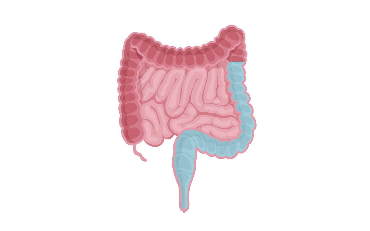Hoog volume darmspoelen